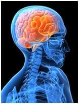 X-ray of human skull with highlighted brain.