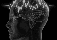 Brain with electrical wave pattern illustration.